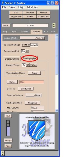 File:TractographyTab.JPG