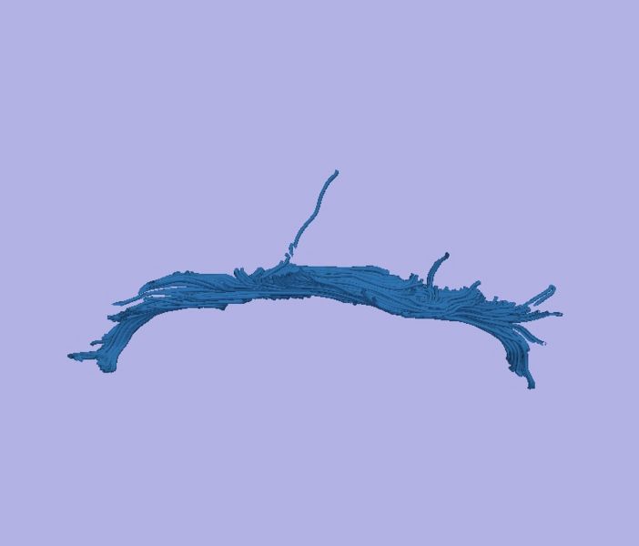 File:CaseD00724 L dil0 sens1.jpg