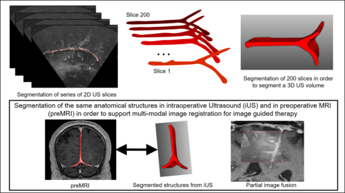 MultimodalImageSegmentation3.png