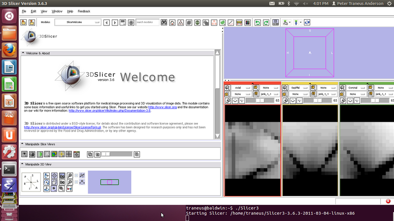 File:Dry0432 1 1 screenshot2013-06-20.png