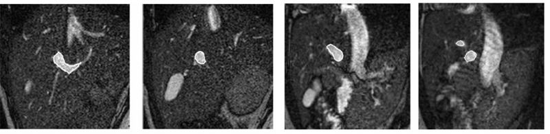File:Portal vein 2D.jpg