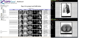 COPDGeneDashboard4.png