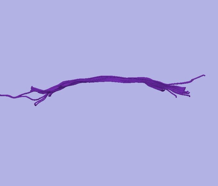 File:CaseD0688 L dil7 sens100.jpg