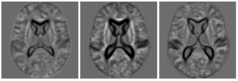 File:Difference templates oasis.png
