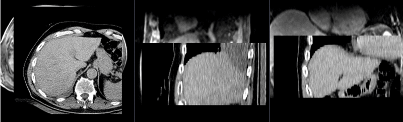 File:RegLib C13 MRCT unregistered.gif