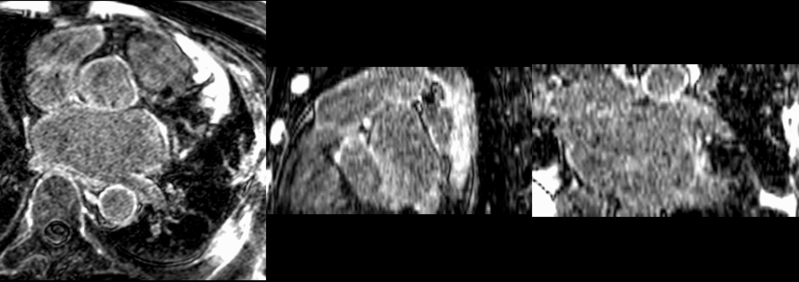 File:Post to pre affine.gif