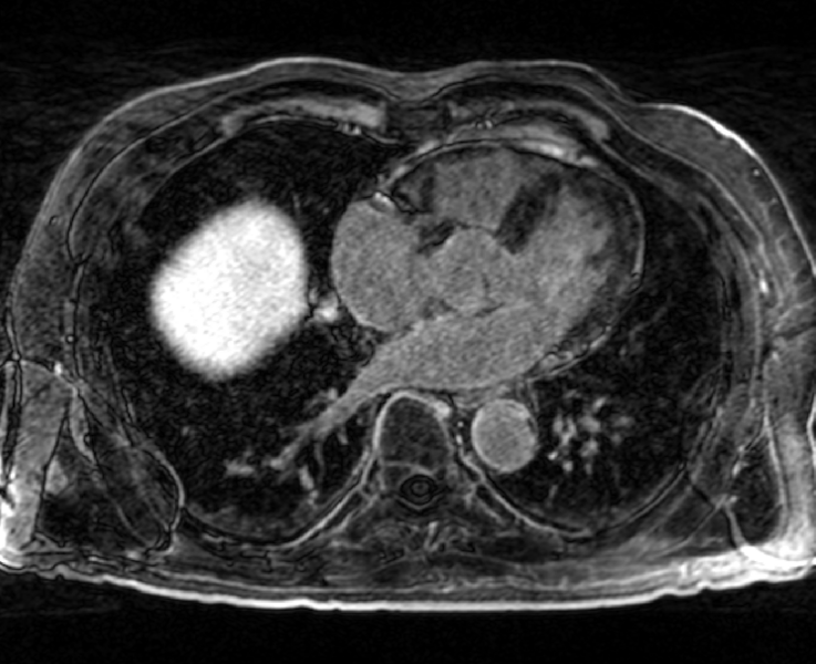 File:Carma ex pre.png