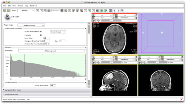 EMSegment Intensity Normalization.png