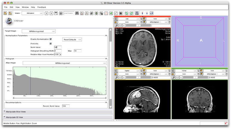 File:EMSegment Intensity Normalization.png
