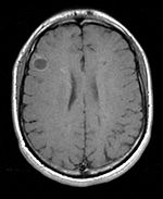 this is a passive image to which the calculated transform is applied. It is a label-map in the same space as the moving FLAIR image