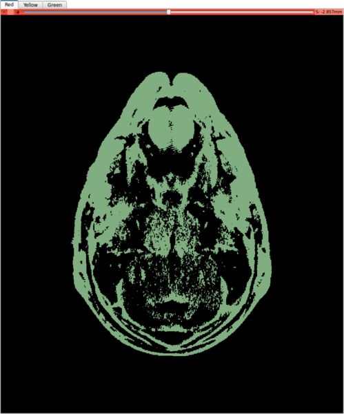 File:Threshold murin skull.png