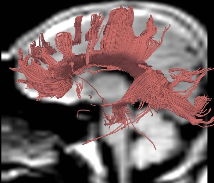 File:CaseD0711 L smoothed.jpg