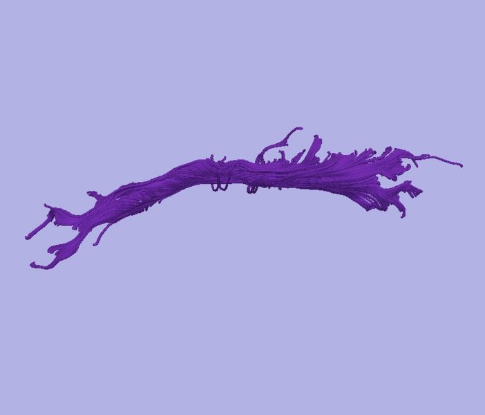 File:CaseD116 L dil3 sens40.jpg