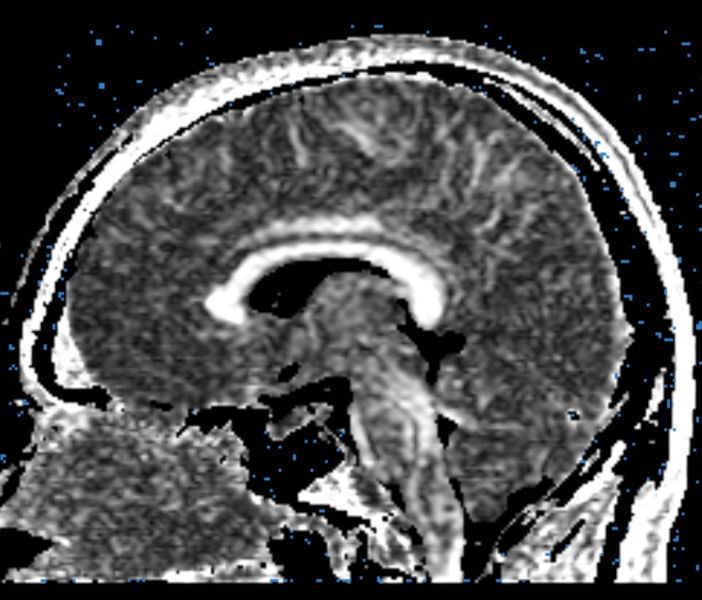 File:CaseD100 B1.jpg