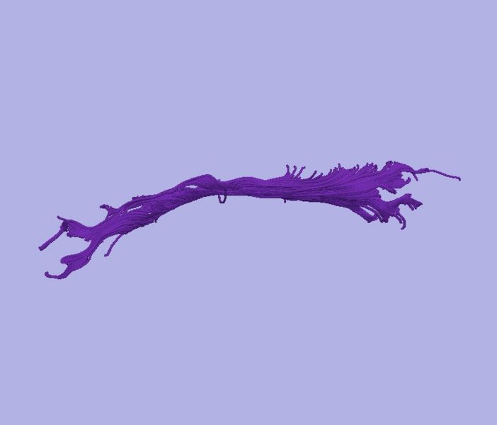 File:CaseD116 L dil5 sens60.jpg