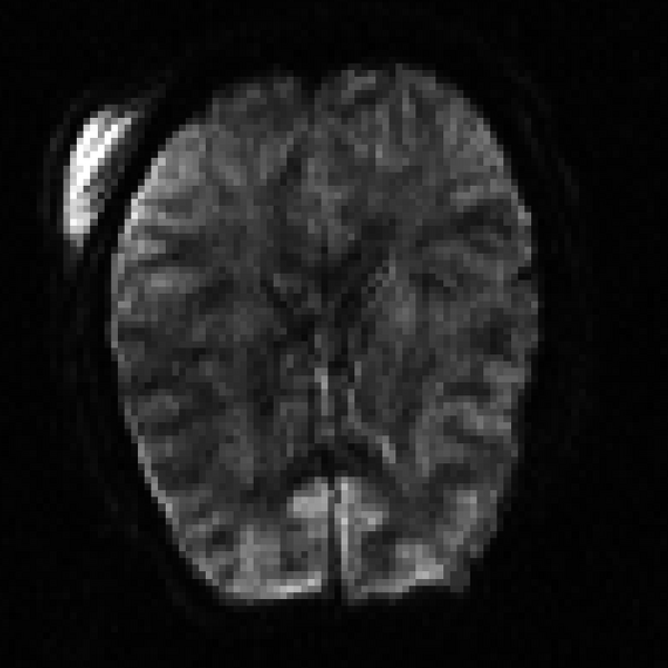 File:DWI sample subject.png