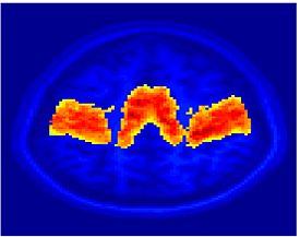 Mit fmri clustering SC 5Clust 4.jpeg