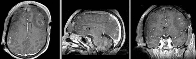 File:RegLib TBI e1 GRE-T1.gif