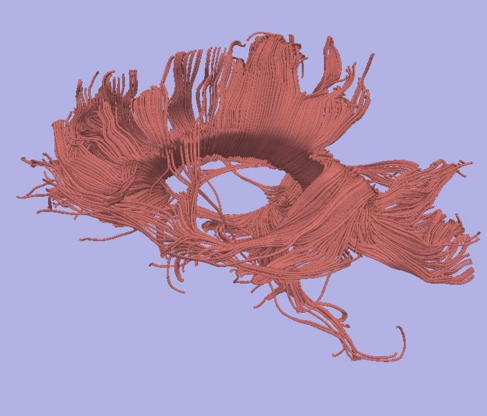 File:Smoothed double0002.jpg