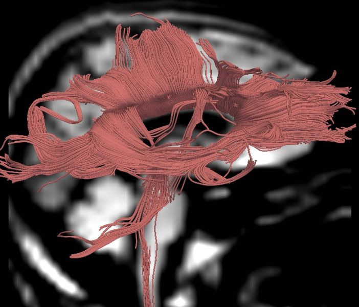 File:CaseD00724 R blur20.jpg