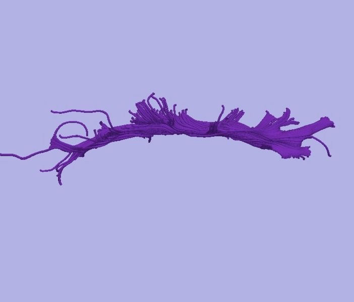 File:CaseD0688 L dil5 sens20.jpg