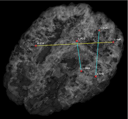 JointVar Anatomical p05 2.jpg
