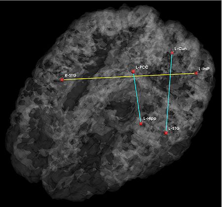 JointVar Anatomical p05 2.jpg