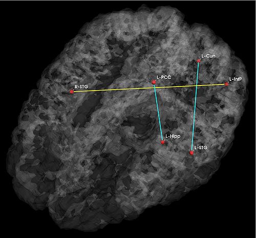 JointVar Anatomical p05 2.jpg