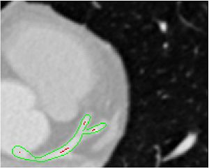 Slice-wise visualization of vessel segmentation