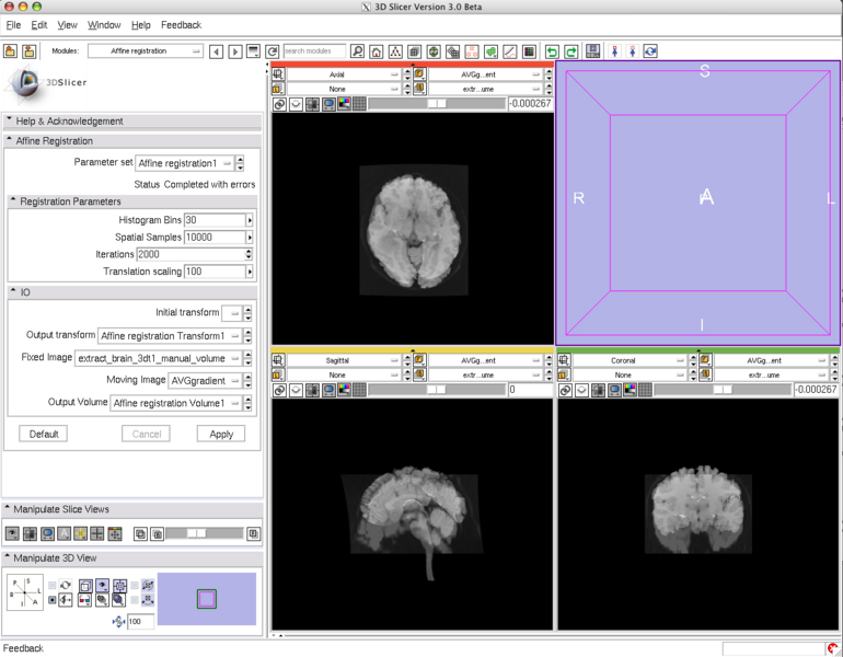 File:Derecen-slicer3-affine.png