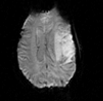 this is the fMRI baseline image, to be registered to the T1