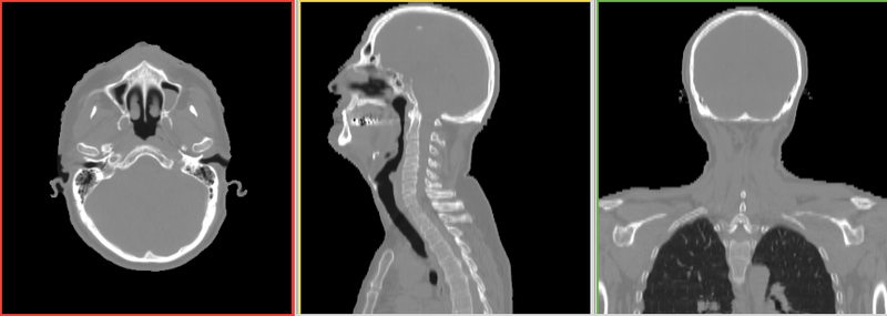 File:RegLib C36 Thumb1.png