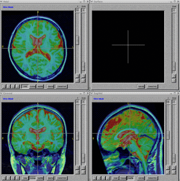 File:BRAINS-Image-Registration.gif