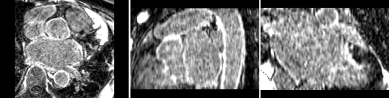 File:Registerimages afib roi reg.gif