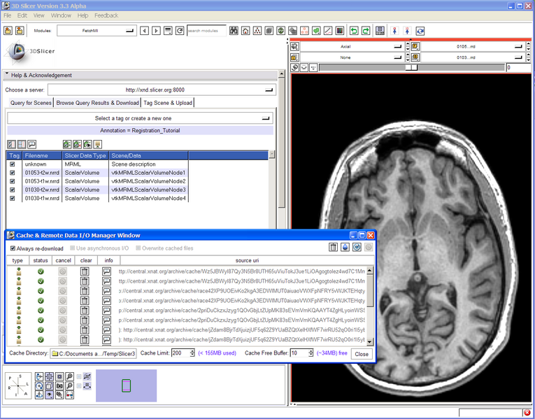 File:FetchMIDoc SlicerRegistration.png
