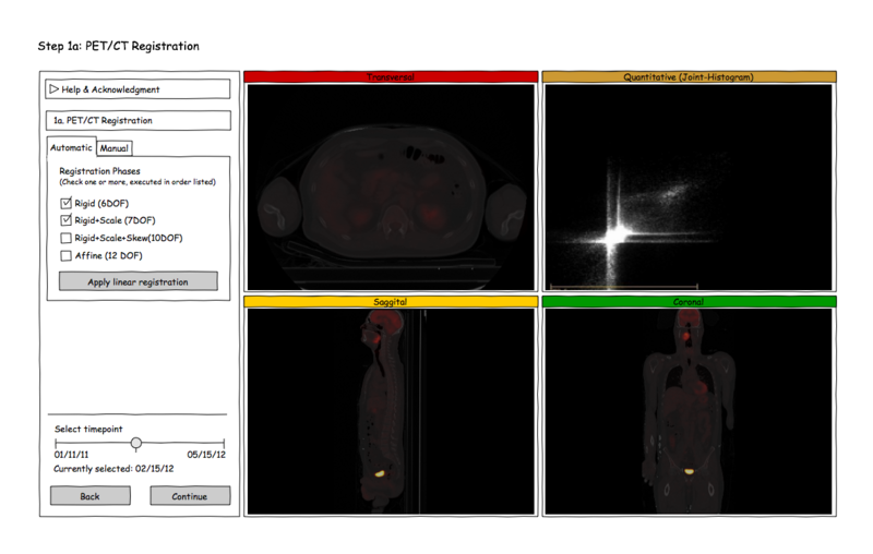 File:Long PETCT Registration-Automatic.png