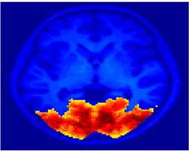 Mit fmri clustering KM 5Clust 4.jpeg