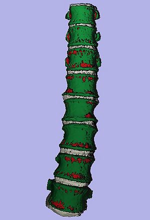 Radnostics Spine Segmentation