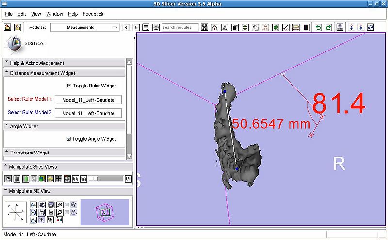 File:SlicerMeasurementGUI-3.5-prototype.jpg