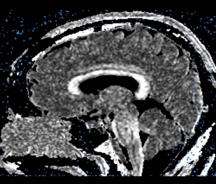 File:CaseD00724 B3.jpg