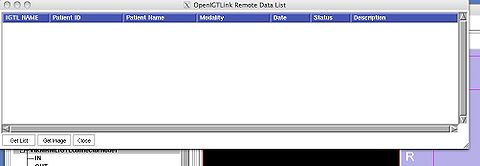 OpenIGTLink ProtocolV2 RemoteDataList2.jpg