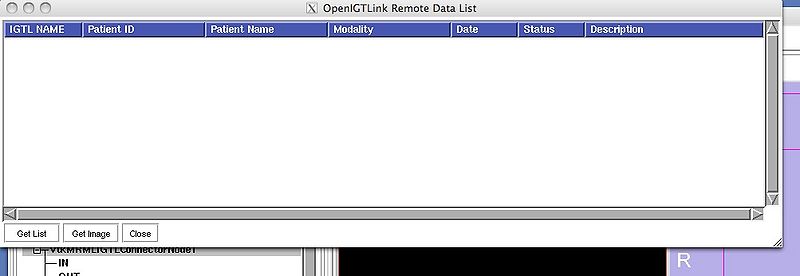 File:OpenIGTLink ProtocolV2 RemoteDataList2.jpg