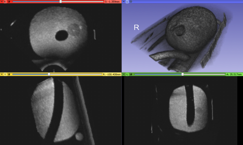 File:Image-2014-06-25-Reconstructed prostate phantom.png