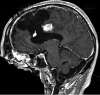 this is the moving image. The transform is calculated by matching this to the reference image
