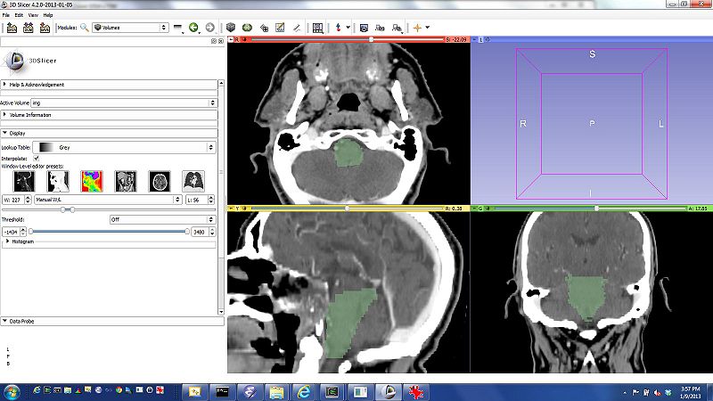 File:NAMIC mabs 2.jpg