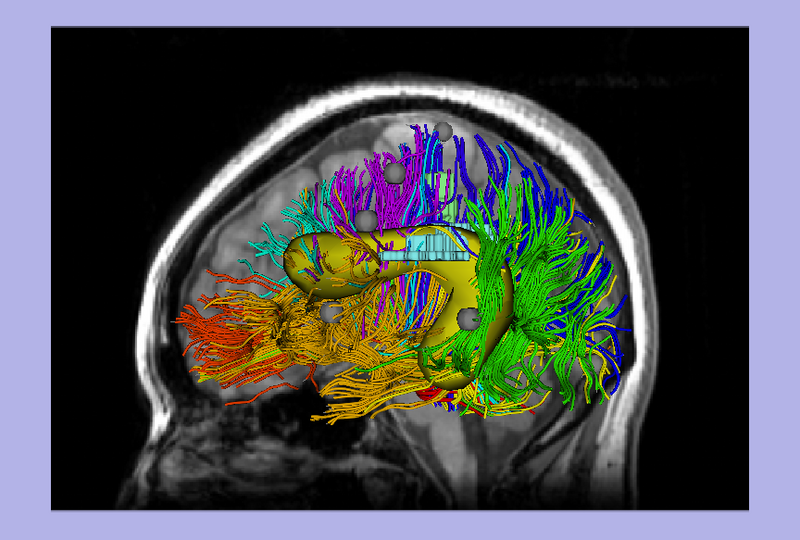 File:SlicerImage 0.png