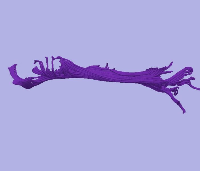 File:CaseD0608 L dil3 sens40.jpg