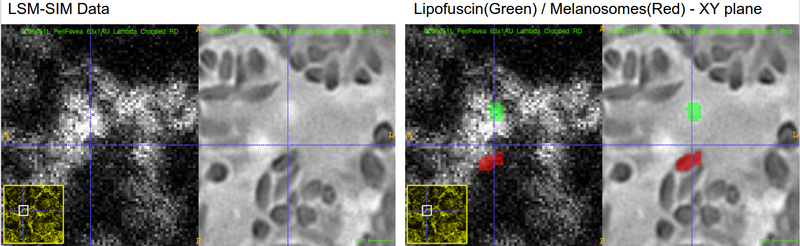 File:LSM SIM Zoomed.png