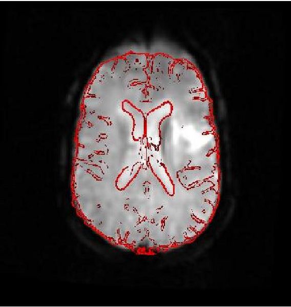 File:Igt poster fig1c.jpg