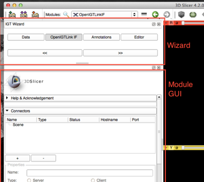 ProjectWeek2013 AbdominalNavigationModule Wizard Screenshot.png